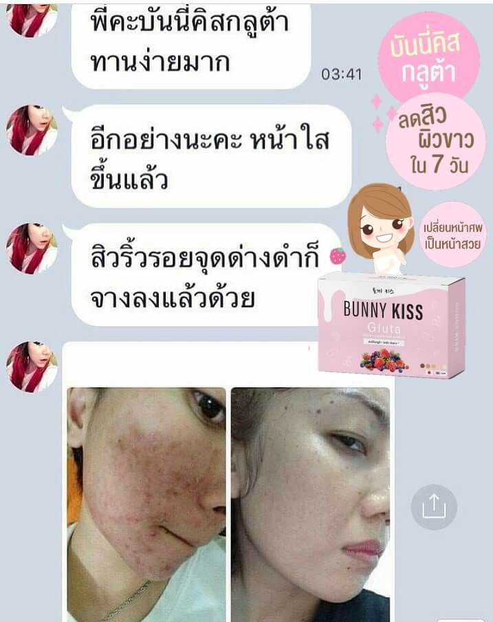 Bunny Kiss Gluta Bunny Kiss Gluta