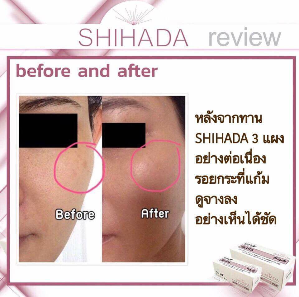 Gluta Shihada กลูต้า ชิฮาดะ 
