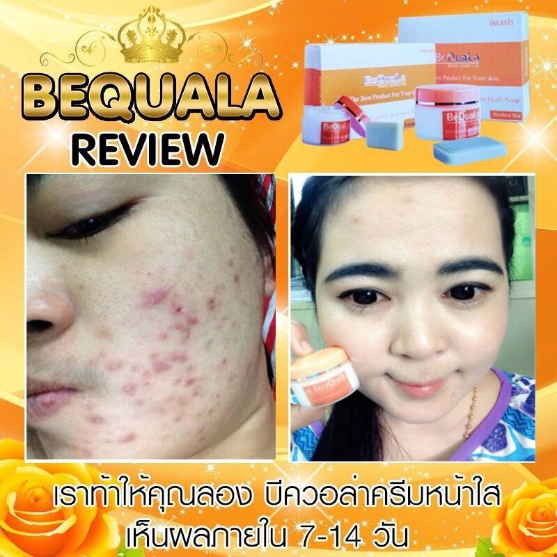 BequaLa ครีมบีควอล่า 